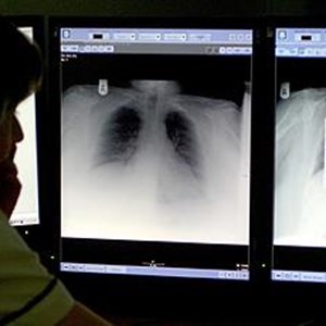 PA-3649472-chest-x-ray-credit-rui-viera-standard.jpg